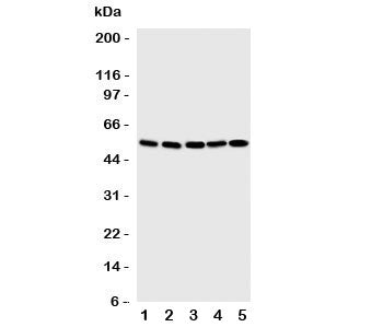 Western blot testing of SMAD1 antibody and Lane 1: SMMC-7721; 2: K562; 3: HT1080; 4: HeLa; 5: Jurkat cell lysate. Predicted molecular weight: 52~60 kDa.
