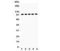 Western blot testing of HCN1 antibody and Lane 1: rat brain; 2: mouse brain; 3: human HeLa; 4: (h) U87; 5: (h) MCF-7 lysate. Predicted/observed size ~99KD