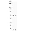 Western blot testing of E2F4 antibody and Lane 1: rat lung; 2: human SMMC-7721 lysate. Expected molecular weight ~44 kDa (unmodified) and 60-65 kDa (phosphorylated).