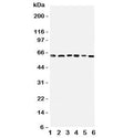 Western blot testing of PDK1 antbody on Lane 1: rat heart; 2: (r) skeletal muscle; and human samples 3: HeLa; 4: M231; 5: COLO320; 6: SW620 cell lysate. Predicted molecular weight ~49 kDa, observed here at ~64 kDa.