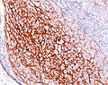 IHC testing of human tonsil stained with CD35 antibody (E11). Note cell membrane staining.