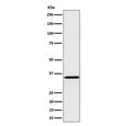 Western blot testing of human HepG2 cell lysate with Pyrophosphatase 1 antibody. Predicted molecular weight ~33 kDa.