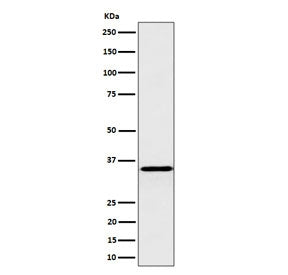 Western blot testing of human HepG2 cell lysate with Pyrophosphatase 1 antibody. Predicted molecular weight ~33 kDa.