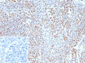 IHC staining of FFPE human tonsil tissue with recombinant Bcl-6 antibody (clone BCL6/9222R). Inset: PBS used in place of primary Ab (secondary Ab negative control). HIER: boil tissue sections in pH 9 10mM Tris with 1mM EDTA for 20 min and allow to cool before testing.