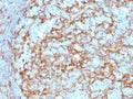 IHC testing of FFPE human lymph node with CD14 antibody (clone LPSR/2385). HIER: boil tissue sections in pH 9 10mM Tris with 1mM EDTA for 10-20 min followed by cooling at RT for 20 min.