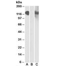 Western blot testing of HEK293 lysate overexpressing CDH11-MYC with CDH11 antibody [1ug/ml] in Lane A and with anti-MYC [1/1000] in lane C. Mock-transfected probed with anti-CDH11 [1ug/ml] in Lane B. Predicted molecular weight: ~88kDa but can be observed at 120-130kDa.