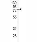 Western blot analysis of TLK2 antibody and mouse testis tissue lysate.