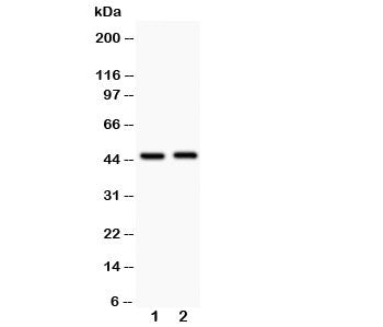 Western blot testing of Beta Arrestin 2 antibody and Lane 1: human HeLa; 2: rat skeletal muscle. Predicted molecular weight: 44~47kDa (isoforms 1-5).
