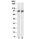 Western blot testing of human A) K562 and B) U937 cell lysates with LFA-1 antibody at 0.3ug/ml. Predicted/observed molecular weight: 85~95 kDa depending on glycosylation level.