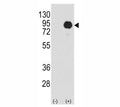 Western blot analysis of BRAF antibody and 293 cell lysate (2 ug/lane) either nontransfected (Lane 1) or transiently transfected with the B-RAF gene (2). Predicted size 85-95 kDa