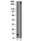 Western blot testing of 1) partial recombinant protein and 2) human lung lysate with vWF antibody (clone VWF/1465). Predicted molecular weight ~250 kDa.