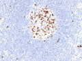 IHC staining of FFPE human lymph node with recombinant Topoisomerase II alpha antibody (clone rTOP2A/6629). HIER: boil tissue sections in pH 9 10mM Tris with 1mM EDTA for 20 min and allow to cool before testing.