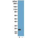 Western blot testing of recombinant His-Tag Chimeric Human antibody (0.2ug/ml) with lysate from HEK293 cells transfected (+) or untransfected (-) with a His-Tag Histone H3 DNA construct. An anti-Human IgG secondary mAb was used as detect.