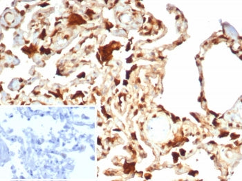 IHC staining of FFPE human lung tissue with S100A11 antibody (clone S100A11/7392). Inset: PBS used in place of primary Ab (secondary Ab negative control). HIER: boil tissue sections in pH 9 10mM Tris with 1mM EDTA for 20 min and allow to cool before testing.