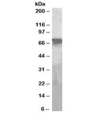 Western blot testing of human liver lysate with PEPCK2 antibody at 2ug/ml. Predicted molecular weight: ~71 kDa.