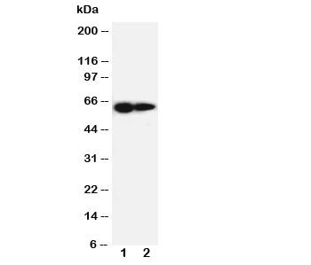 Western blot testing of IL-2 Receptor antibody and Lane 1: PANC cell lysate ; 2: HeLa cell lysate. Expected molecular weight ~61 kDa (unmodified), 70-75 kDa (glycosylated).