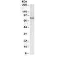 Western blot testing of HepG2 lysate with ACSL4 antibody at 0.1ug/ml. Predicted molecular weight: ~80 kDa (long form), ~74 kDa (short form).