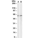 Western blot testing of human [A] and rat [B] lung lysates with Calreticulin antibody at 0.01ug/ml. Predicted molecular weight ~48kDa but routinely observed at 55~60kDa.