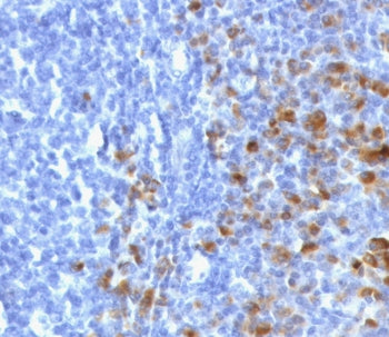IHC staining of FFPE human tonsil tissue with recombinant IgG antibody (clone GHC07-2R). Required HIER: boil tissue sections in 10mM citrate buffer, pH6, for 10-20 min followed by cooling at RT for 20 min.
