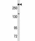 Dicer antibody western blot analysis in HepG2 lysate