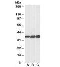 Western blot testing of human [A], mouse [B] and rat [C] heart lysates with Lactate Dehydrogenase B antibody at 0.1ug/ml. Predicted molecular weight: ~36kDa.