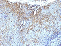 IHC: Formalin-fixed, paraffin-embedded human tongue stained with CD59 antibody (SPM616)