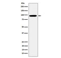 Western blot testing of human K562 cell lysate with EPN1 antibody. Predicted molecular weight: 58-69 kDa (multiple isoforms).