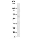 Western blot testing of human liver lysate with CES1 antibody at 0.03ug/ml. Predicted molecular weight: ~63 kDa.