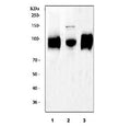 Western blot testing of 1) rat spleen, 2) mouse spleen and 3) mouse RAW264.7 cell lysate with Cd68 antibody. This protein can be highly glycosylated and is routinely visualized from 37~110 kDa.