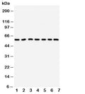 Western blot testing of CYP11B1 antibody and Lane 1: HeLa; 2: U87; 3: MM231; 4: PANC; 5: MM453; 6: HeLa; 7: SMMC-7721 cell lysate. Predicted size: 58KD
