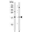 Western blot testing of human 1) HL60 and 2) Jurkat cell lysate with KiSS-1 antibody. Predicted molecular weight ~15 kDa, commonly observed at 15-20 kDa.