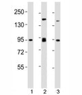 Western blot testing of SUZ12 antibody at 1:2000 dilution. Lane 1: mouse spleen lysate; 2: F9 lysate; 3: HeLa lysate; Observed molecular weight 83~95 kDa.