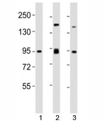 Western blot testing of SUZ12 antibody at 1:2000 dilution. Lane 1: mouse spleen lysate; 2: F9 lysate; 3: HeLa lysate; Observed molecular weight 83~95 kDa.