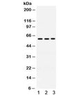 Western blot testing of human 1) A549, 2) 22RV1 and 3) U20S cell lysate with RAG2 antibody. Expected/observed molecular weight ~59 kDa.