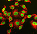 Immunofluorescent staining of RNF220 using anti-RNF220 antibody (green) and anti-Beta Tubulin antibody (red). RNF220 was detected in an immunocytochemical section of Hela cells. Enzyme antigen retrieval was performed using IHC enzyme antigen retrieval reagent for 15 mins. The cells were blocked with 10% goat serum. And then incubated with 5 ug/ml rabbit anti-RNF220 antibody and mouse anti-Beta Tubulin antibody overnight at 4oC.