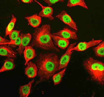 Immunofluorescent staining of RNF220 using anti-RNF220 antibody (green) and anti-Beta Tubulin antibody (red). RNF220 was detected in an immunocytochemical section of Hela cells. Enzyme antigen retrieval was performed using IHC enzyme antigen retrieval reagent for 15 mins. The cells were blocked with 10% goat serum. And then incubated with 5 ug/ml rabbit anti-RNF220 antibody and mouse anti-Beta Tubulin antibody overnight at 4oC.