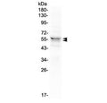 Western blot testing of human 293T cell lysate with LYN antibody at 0.5ug/ml. Predicted molecular weight ~53 kDa (p53lyn), ~56 kDa (p56lyn).