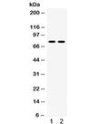Western blot testing of 1) mouse testis and 2) human 22RV1 lysate with MDM4 antibody. Predicted molecular weight ~55 kDa but may be observed at higher molecular weights due to phosphorylation.