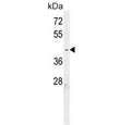 Western blot testing of human K562 cell lysate with C6orf58 antibody. Predicted molecular weight ~40 kDa.