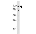 Western blot testing of human U-251 MG cell lysate with SH2B3 antibody at 1:2000. Predicted molecular weight ~63 kDa.