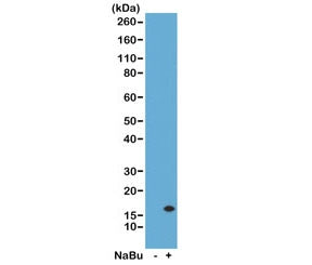 Western Blot of acid extracts from human HeLa cells untreated (-) or treated (+) with sodium butyrate using the recombinant H3K14ac antibody at 0.5 ug/ml.