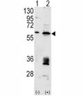 Western blot analysis of anti-MDM2 antibody and 293 cell lysate (2 ug/lane) either nontransfected (Lane 1) or transiently transfected with the MDM2 gene (2).