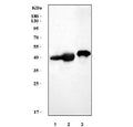 Western blot testing of 1) rat kidney, 2) rat skeletal muscle and 3) mouse skeletal muscle tissue lysate with MAP2K6 antibody. Predicted molecular weight ~37 kDa.