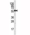 Western blot analysis of SIGLEC7 antibody and NCI-H460 lysate.