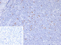 IHC staining of FFPE human tonsil tissue with Scurfin antibody (clone FOXP3/8145R). Inset: PBS used in place of primary Ab (secondary Ab negative control). HIER: boil tissue sections in pH 9 10mM Tris with 1mM EDTA for 20 min and allow to cool before testing.