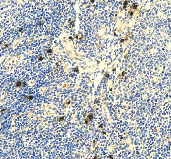 Immunohistochemical staining of RNF111 using anti-RNF111 antibody. RNF111 was detected in a paraffin-embedded section of human tonsil tissue. Heat mediated antigen retrieval was performed in EDTA buffer (pH 8.0, epitope retrieval solution). The tissue section was blocked with 10% goat serum. The tissue section was then incubated with 2 ug/ml rabbit anti-RNF111 antibody overnight at 4oC. Peroxidase Conjugated Goat Anti-rabbit IgG was used as secondary antibody and incubated for 30 min at 37oC.
