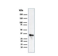 Western blot testing of human Raji cell lysate with CLIP antibody (clone CLIP/813). Expected molecular weight: 33-43 kDa.