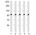 Western blot testing of human 1) CCRF-CEM, 2) Jurkat, 3) liver, 4) MCF7 and 5) HL60 lysate with RSBN1 antibody. Predicted molecular weight ~91 kDa.