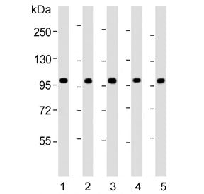 Western blot testing of human 1) CCRF-CEM, 2) Jurkat, 3) liver, 4) MCF7 and 5) HL60 lysate with RSBN1 antibody. Predicted molecular weight ~91 kDa.