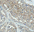 IHC staining of FFPE human liver tissue with DDT antibody. HIER: boil tissue sections in pH8 EDTA for 10-20 min followed by cooling at RT for 20 min.